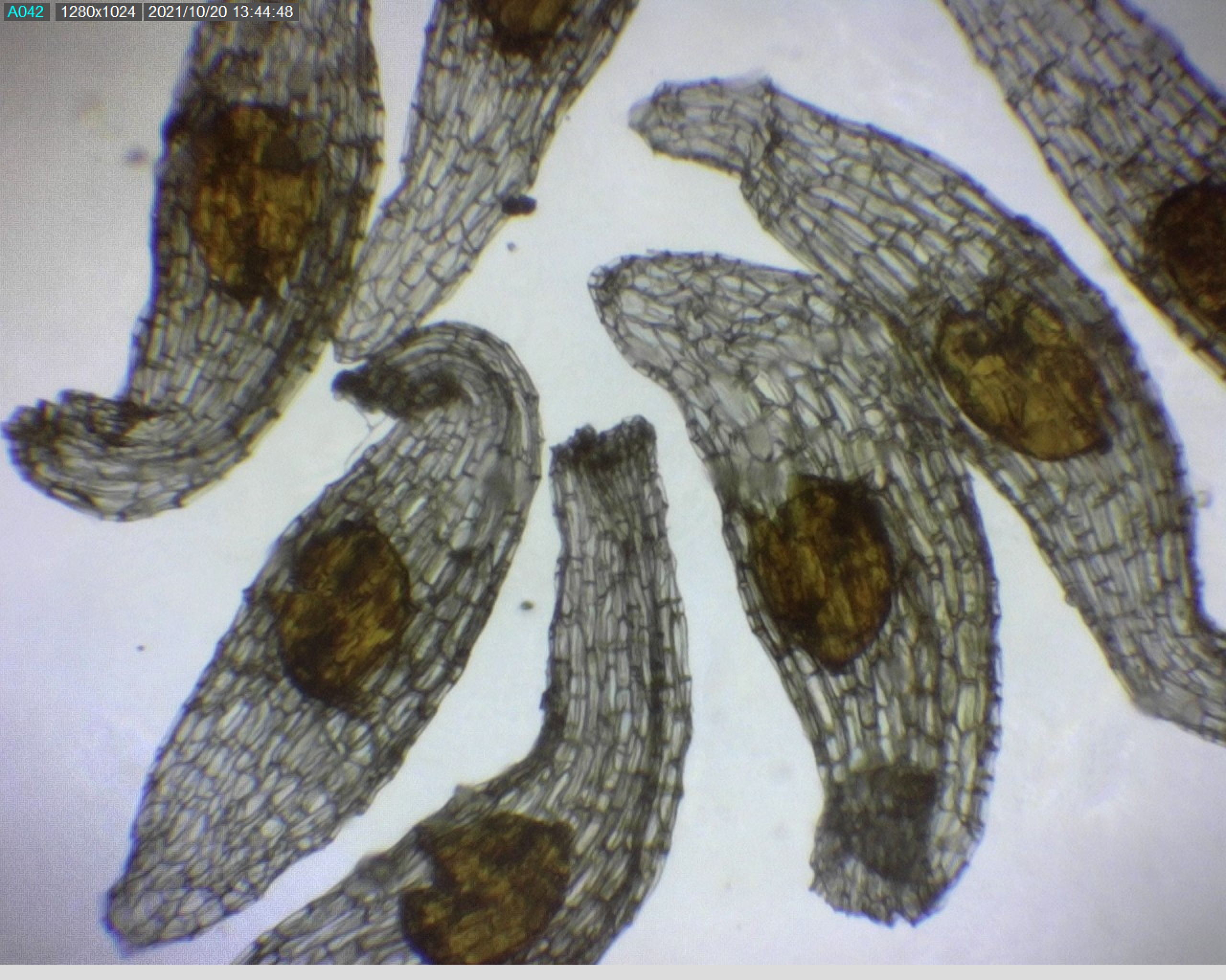Hlistnik-hnizdak-semena---Jak-na-mikroskop