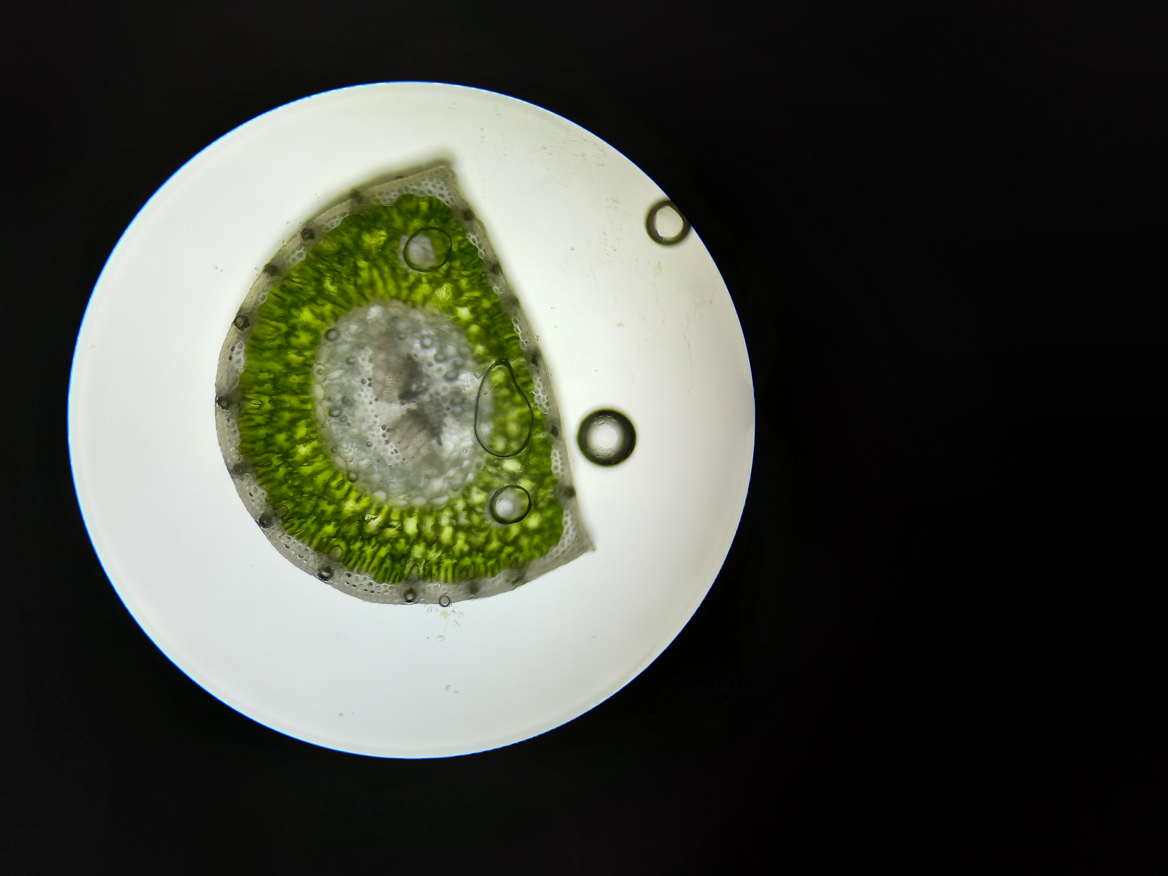 Rez-jehlici-borovice---jehlici-pod-mikroskopem