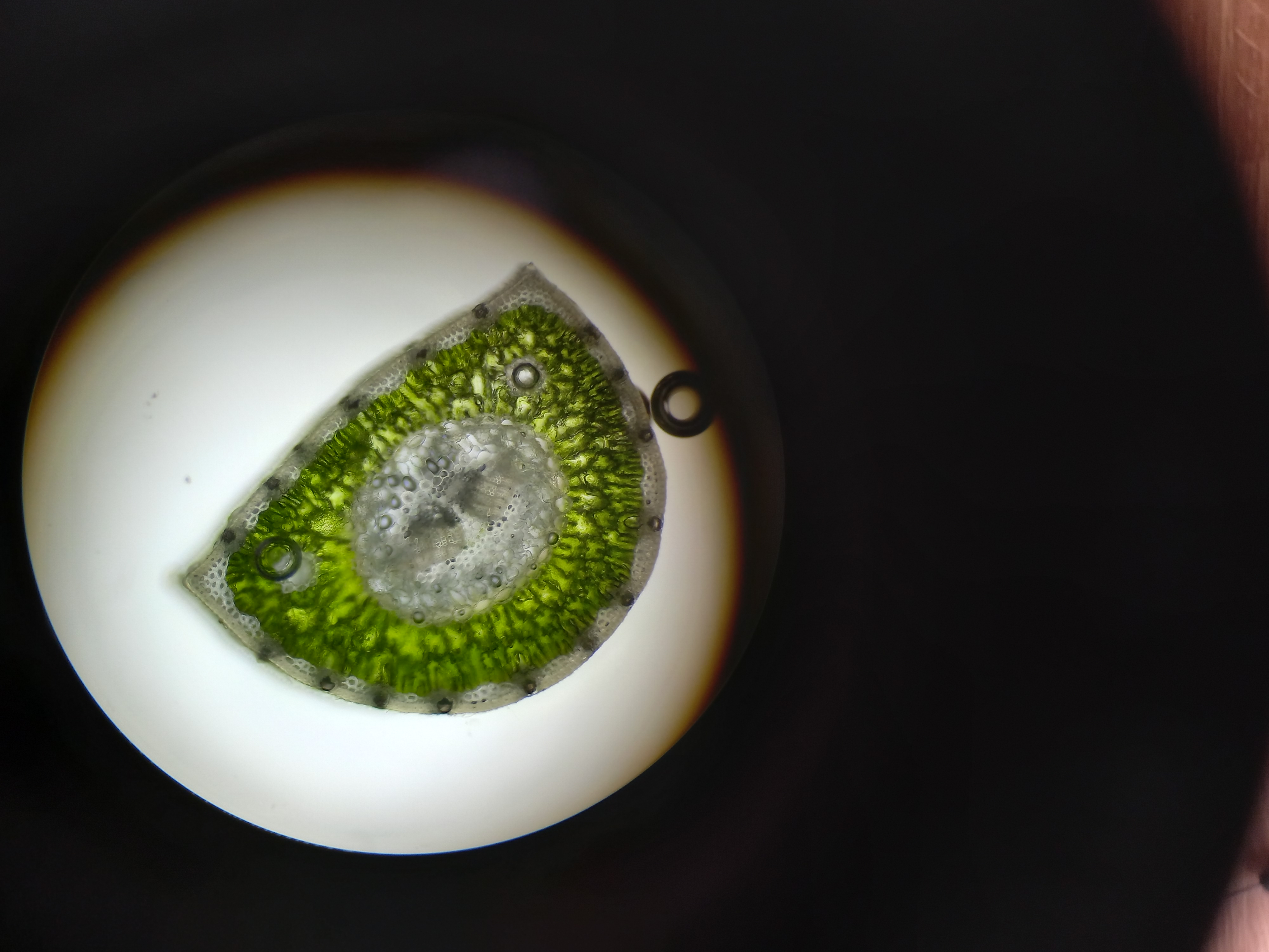 Rez-jehlici-borovice-II---Jehlici-pod-mikroskopem
